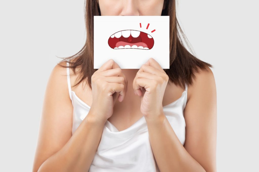 Diente caído golpe Traumatismo dental